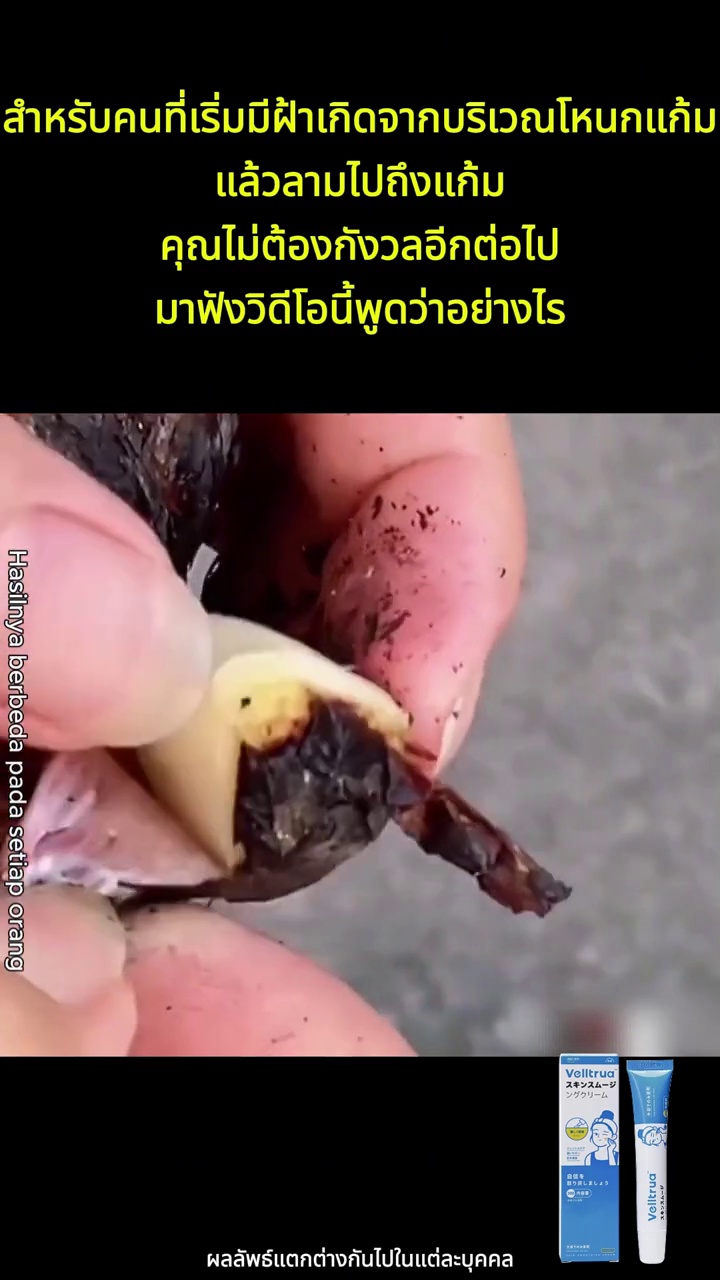 #[เห็นผลลัพธ์ในวันเดียวกัน]ครีมบำรุงรอบดวงตาต่อต้านริ้วรอย ช่วยลดรอยคล้ำใต้ตา ขจัดอาการบวมและถุงใต้ตา ทำให้บริเวณรอบดวงตาสว่างขึ้น กระชับผิว และล