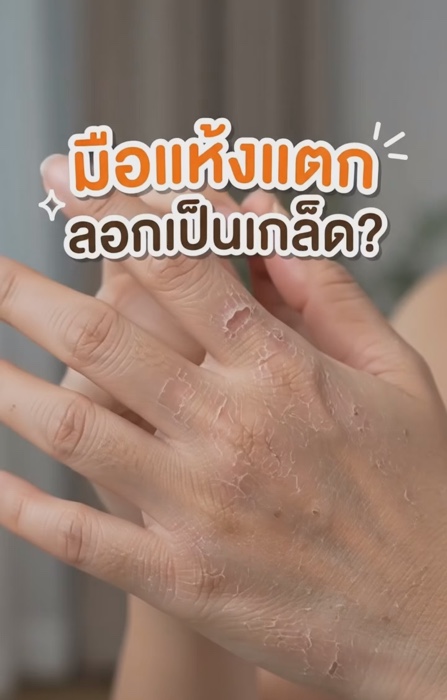 #ครีมทามือ #รีวิวบิวตี้ #มือแห้ง #ครีมน้ำมันม้า #ดูแลมือ #ผิวแห้ง  #ของดีบอกต่อ #ช้อปปี้ป้ายยา #ถูกและดี